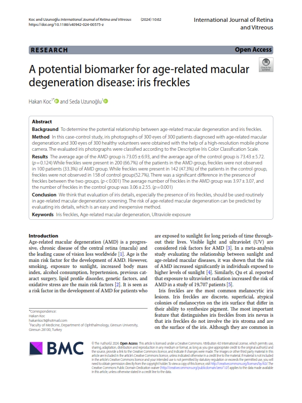 A potential biomarker for age-related macular
degeneration disease: iris freckles